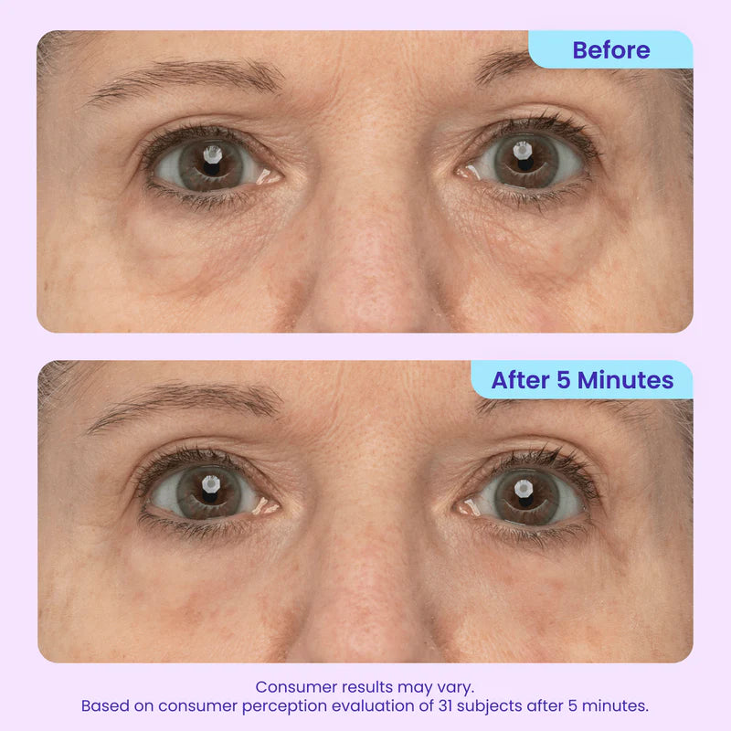 NacoVela InstaLift Eye Gel – 5 Minute Under Eye Tightening & Anti-Wrinkle Gel
