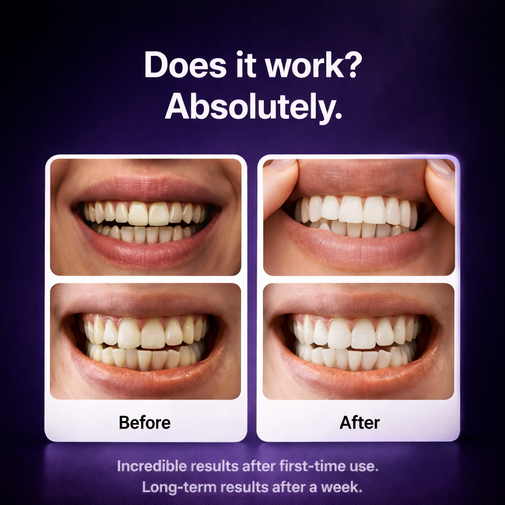 Enamel-Safe Teeth Whitening Strips (Gen 2 Purple Formula)