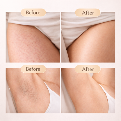 Hair Removal Essential Oil