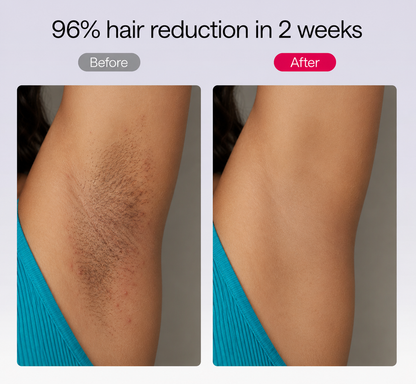 NacoVela™ Cyperus Rotundus Hair Reduction Oil — Post-Shave Smoothing Treatment