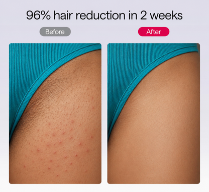 NacoVela™ Cyperus Rotundus Hair Reduction Oil — Post-Shave Smoothing Treatment