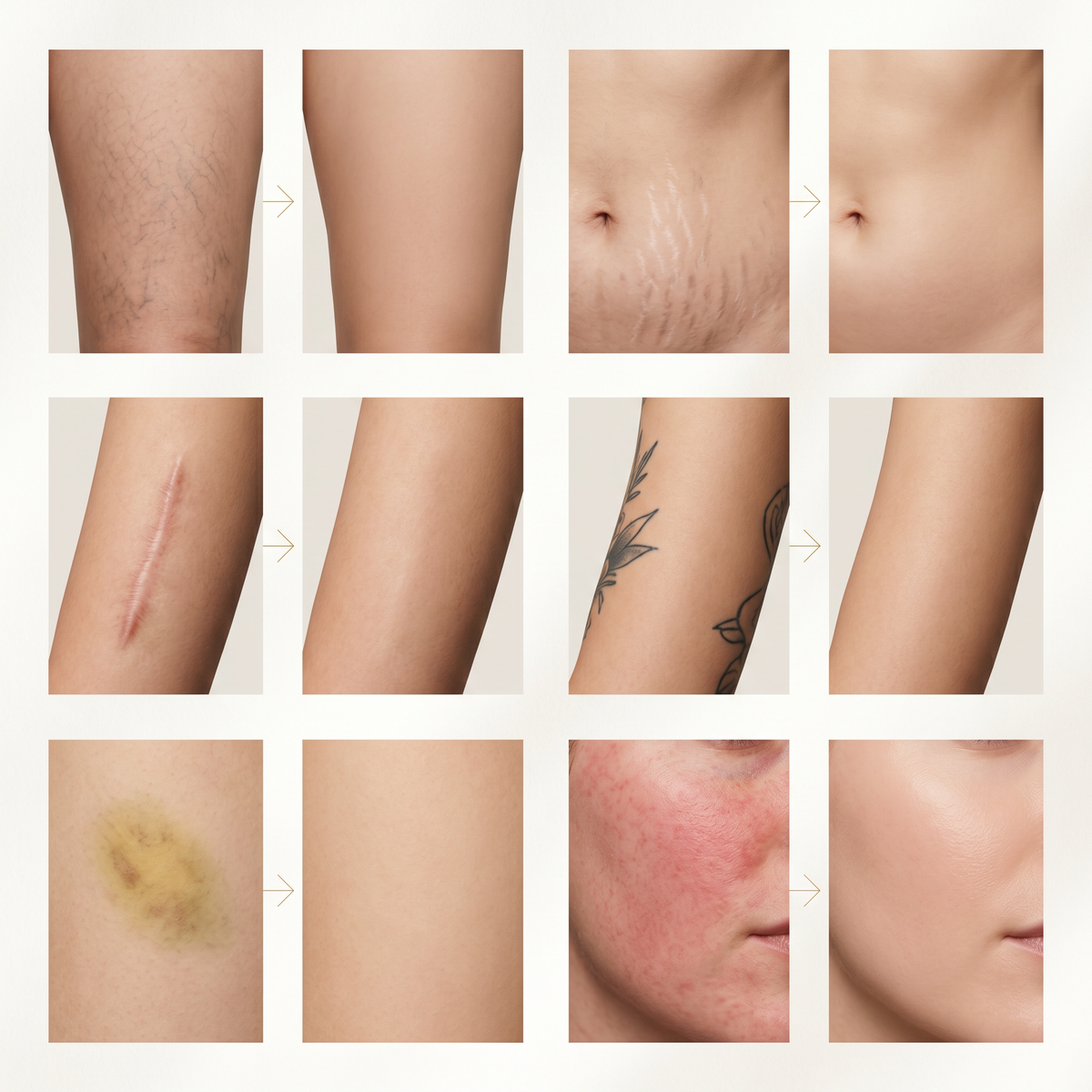 NacoVela Body Veil™  Waterproof Body Perfector
