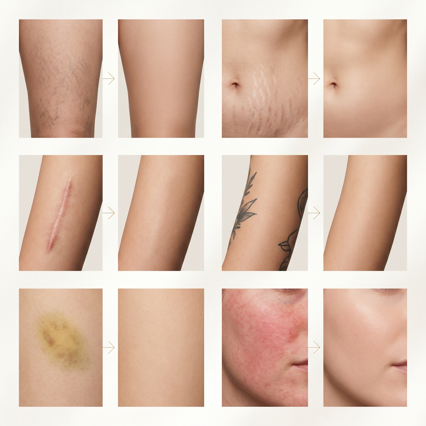 NacoVela Body Veil™  Waterproof Body Perfector