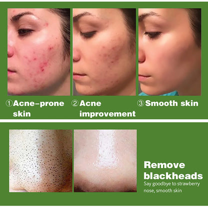 AILKE Organic Turmeric Whitening Skin Care Set, with Vitamin C, Clean Skin, Reduce Acne, Hydrating and Firming for Women
